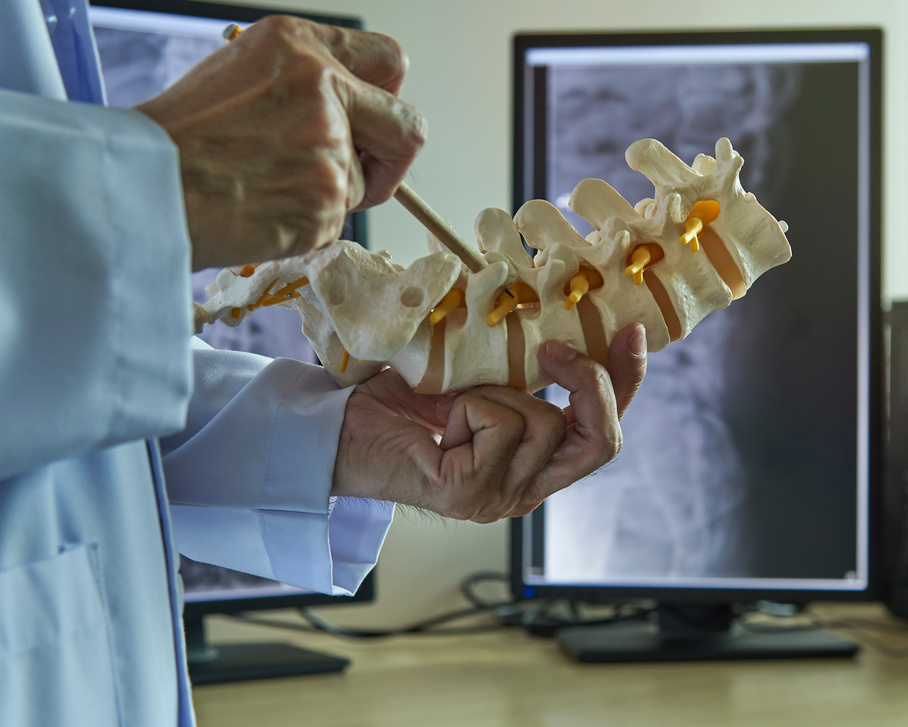 A neurosurgeon  pointing at nerve root of lumbar vertebra model